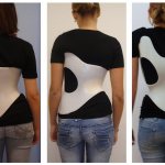 Back corset for scoliosis