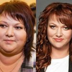 No fat (and no cheeks): faces of Russian stars after losing weight - Olga Kartunkova