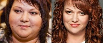 No fat (and no cheeks): faces of Russian stars after losing weight - Olga Kartunkova